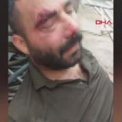 12 metre yükseklikten beton zemine düşen işçi: Ailemin tek geçim kaynağı benim