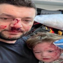 Kucağındaki bebeğiyle darbedilen babanın feryadı: Kızım çırpınırken tekrar vurdu