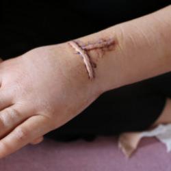 Diyarbakır'da kan donduran olay! Eşini 30 yerinden bıçakladı 