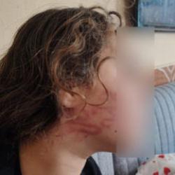 Adana'da 11 yaşındaki çocuğa darp iddiası! Allah için yapma dedim