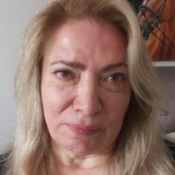 Ankara'da estetik kabusu: Yüz felci geçirdiğini iddia etti 