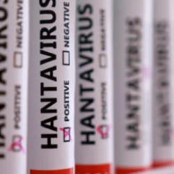 Herkesin aklında tek soru! Hantavirüs insandan insana bulaşır mı?