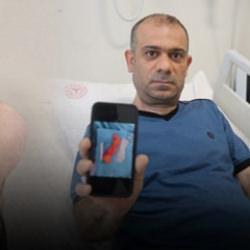 Sırtındaki şişliği önemsemedi! Yıllar içinde büyüdü! Doktorları şoke eden vaka