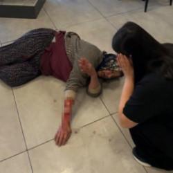 Afyonkarahisar'da köpek dehşeti! Sürüklediği kadının kolunu kopardı