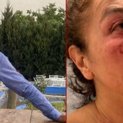 Yalanla ayağına çağırdı öldüresiye dövdü! Saldırgan belediye çalışanı çıktı