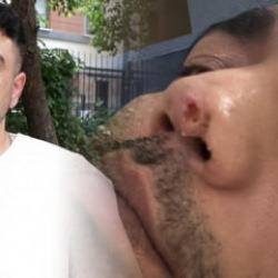 Horlama şikayeti ile başlayan 7 yıllık kabus! 