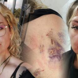 15 dakika boyunca bıçaklanan Özge: Bıçak kırılmasaydı zaten yaşama şansım yoktu
