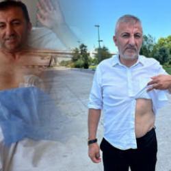 Vücudundaki kurşunla 10 yıldır yaşayan 15 Temmuz Gazisi Musa İlhan o geceyi anlattı 