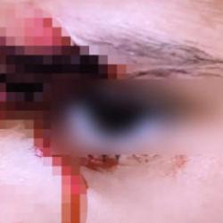 Şanlıurfa'da köpek dehşeti! 8 yaşındaki çocuk kanlar içinde kaldı 