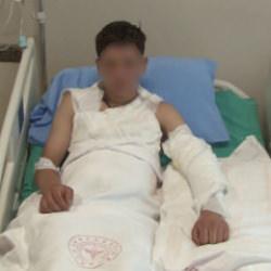 Merakı başına iş aştı! Vücudunun yüzde 25'i yandı... Kolonya şişesi bomba gibi patladı