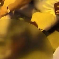 Köpeğine saldıran, pitbull cinsi köpeğin sahibini 3 yerinden bıçakladı 