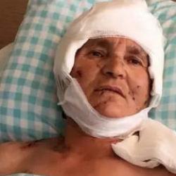 Kırşehir'de köpek saldırısına uğrayan 63 yaşındaki kadına tazminat ödenecek