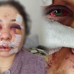Ankara'da karısını darbeden polis memuruna 'haksız tahrik' ve 'iyi hal' indirimi