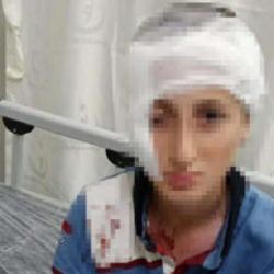 İzmir'de köpek saldırısına uğrayan 11 yaşındaki çocuğa emsal niteliğinde tazminat 