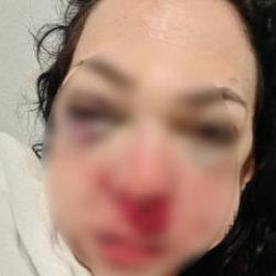 Kocaeli'de öldüresiye dövülmüştü! Tutuklu sayısı arttı 