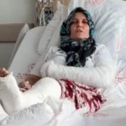 Mersin'de saldırı! 3 çocuk annesinin kolu ve bacağı kırıldı: 4 tutuklu 