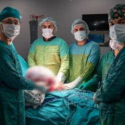 Karın ağrısıyla doktora gitti gerçeği görünce şaşkına döndü! Tam 15 kg çıkarıldı...