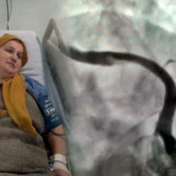 Zonguldak'ta doktoru şoke eden vaka! Öksürürken kalp damarı yırtıldı 