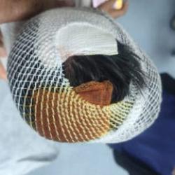 Şanlıurfa'da köpek sürüsü dehşeti! Çocuk kan revan içinde kaldı