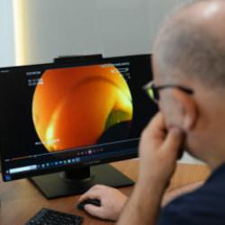 Uzman isim uyardı: Sosyal medyadaki bakırsak detoksu trendi sağlığı tehdit ediyor