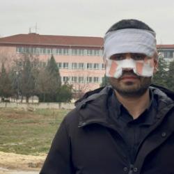 Okulda korku dolu anlar! Eskişehir'de &ouml;ğretmen meslektaşının y&uuml;z&uuml;n&uuml; yaktı iddiası