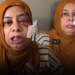 Hatay'da korkun&ccedil; kaza: Dişleri kırıldı, y&uuml;z&uuml;ne 14 dikiş atıldı 