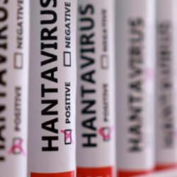 Son dakika: Bakanlıktan 'hantavir&uuml;s' a&ccedil;ıklaması: 'Tespit edilmedi'