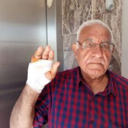 Hatay'da akılalmaz hadise: Komşusunun ısırdığı parmak koparıldı 