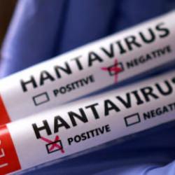 İsrail'de hantavir&uuml;s alarmı! İlk vaka kaydedildi