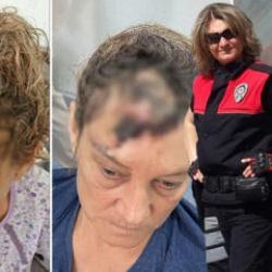 V&uuml;cuduna 80 dikiş atıldı: Patronunun k&ouml;peği tarafından par&ccedil;alanan koruma isyan etti