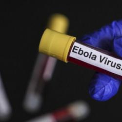 Ebola alarmında "T&uuml;rkiye" sorusu: Şu anda bir risk s&ouml;z konusu değil!