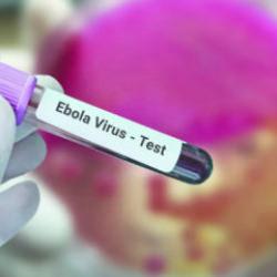 Fransa'da ebola vakası g&ouml;r&uuml;ld&uuml;