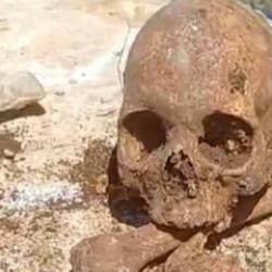 Malatya'da t&uuml;yler &uuml;rperten olay! Temel kazısı sırasında bulundu