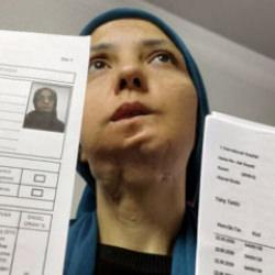 11 yılda 35 kez ameliyat oldu: 3 &ccedil;ocuk annesi kadının dili kesilebilir