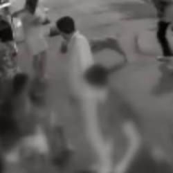 &lsquo;K&ouml;peğini tut&rsquo; uyarısı dehşete d&ouml;n&uuml;şt&uuml;: Pitbull sahibini 3 yerinden bı&ccedil;akladı