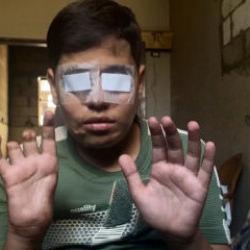 İsrail'in hayatını kararttığı Ebu Şab'ın tek bir isteği var: Yeniden okula gitmek