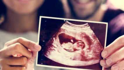 Bebeğin cinsiyeti değişir mi? Hamilelikte cinsiyet yanılması kaçıncı haftadan sonra olur?