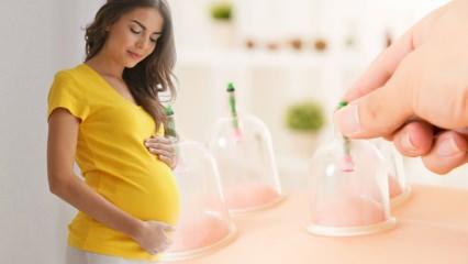 Hamilelik için hacamat nereye yapılır? Hamilelikte hacamatın faydaları