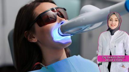 Diş beyazlatma (Bleaching)  yöntemi nasıl yapılır? Bleaching yöntemi dişlere zarar verir mi?