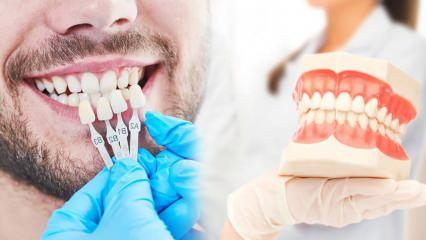 Dişlere zirkonyum kaplama neden yapılır? Zirkonyum kaplama ne kadar dayanıklıdır?