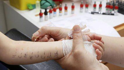 Çocuklarda alerji testi nasıl yapılır? Deri prick testi nedir?