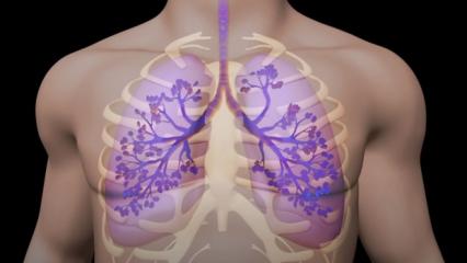 Akciğeri temizleyen keçiboynuzu kürü nasıl hazırlanır? 1 haftada akciğeri toksinlerden arındıran kür tarifi...