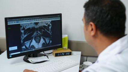 Prostat kanserinde erken ve doğru tanı için "Füzyon biyopsi" dönemi