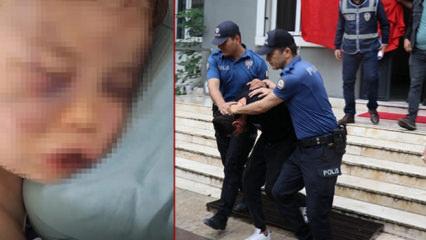 2 yaşındaki bebeği darbederek hastanelik etmişlerdi! Anne hakkında gelişme 