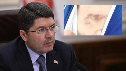 İBB kreşinde &ccedil;ocuğa darp ve istismar! Bakanlardan peş peşe a&ccedil;ıklama: 'İhbarlar ciddi'