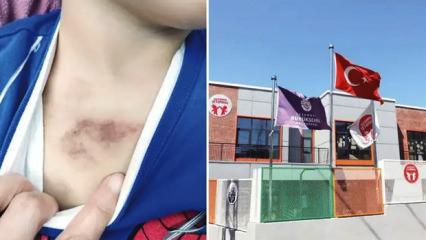 İBB kreşindeki dehşet soruşturmasında iğren&ccedil; detaylar: &Ccedil;ıplakken kameraya &ccedil;ekti