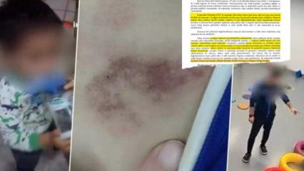 İBB&rsquo;den medyaya baskı babaya itham! Kreşteki rezaleti mağdur aileye yıktılar