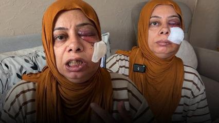 Hatay'da korkun&ccedil; kaza: Dişleri kırıldı, y&uuml;z&uuml;ne 14 dikiş atıldı 