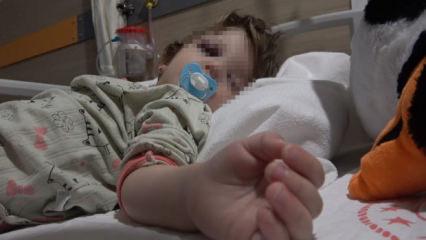 Korkun&ccedil; olay! 14 aylık bebeğin kafatası &ccedil;atladı! Bakan G&uuml;rlek'ten son dakika a&ccedil;ıklaması