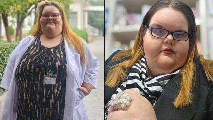 Kilosu nedeniyle akran zorbalığı g&ouml;rd&uuml;, 50 kilo verdi!